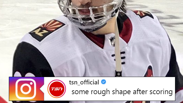 Conor Garland S Face Looks Very Roughed Up After He Scored A Goal Directly Off His Face Article Bardown