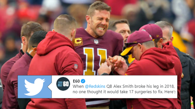 Alex Smith S Leg Injury Almost Killed Him Still Looks Really Bad After 17 Surgeries Near Amputation Article Bardown