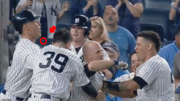 Watch: Aaron Judge's tooth flies off during home run celebration 