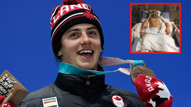 Mark McMorris